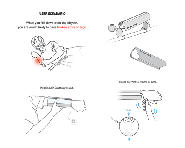 Platre gonflable pour fracture